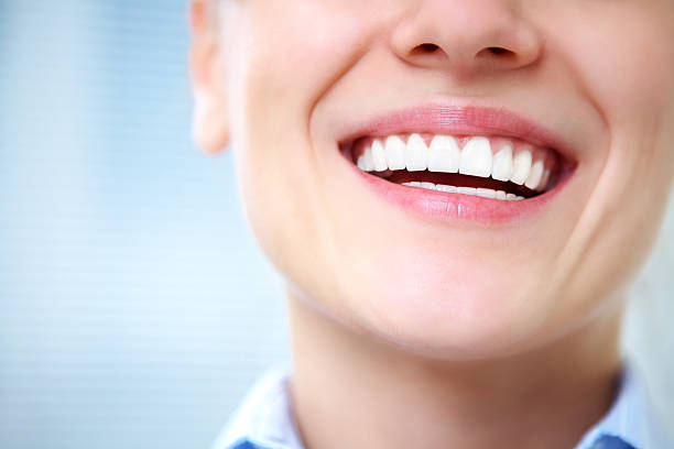 how long does it take to whiten teeth?